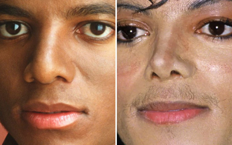 Какого цвета кожа была у Майкла Джексона?